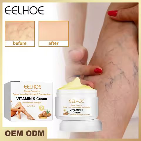 Vitamin K Cream Skin Care to Relieve Leg Soreness and Swelling, Varicose Vein Massage Care Cream