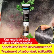 Seborrheic Folliculitis Cream,dermatitis cream,folliculitis, anti-itch cream,  seborrheic folliculitis, head psoriasis, psoriasis, seborrheic dermatitis, anti-itch ointmen,Eczema cream,treatment cream