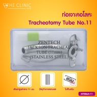 TRACHEOTOMY TUBE STAINLESS ท่อเจาะคอโลหะ ทำจากสแตนเลส / THE CLINIC HUB