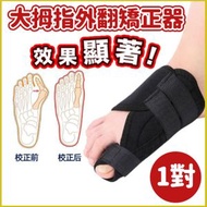 【1對】大拇指外翻矯正器 成人護理腳骨 可穿鞋 拇外翻分趾器