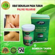 ( TERLARIS ) SALEP KHUSUS BENJOLAN AR-RAIHAN - MENGOBATI BENJOLAN - GONDOK - TUMOR  obat kista  benjolan kista Qahira minyak Qahira salep benjolan lipoma salep untuk mengatasi benjolan lipoma salep terbaik