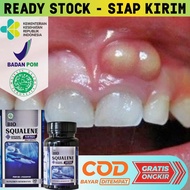 [COD] Obat Abses Gusi Herbal - Obat Abses Gusi Pada Anak - Obat Gusi Bernanah Radang Nyeri Gusi - Ob