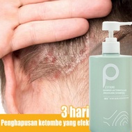 LIFUSHA Shampo anti ketombe Shampo rambut rontok mite removal Shampo penumbuh rambut cepat 500ml Jah