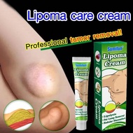 ubat benjolan hand lipoma cream benjolan lipoma removal cream Removal Multiple Single Lipoma Subcuta