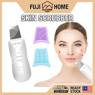 🏠READY STOCK🏠Ultrasonic Facial Scrubber Blackhead Removal EMS Face Massager Whitehead Removal Pores 