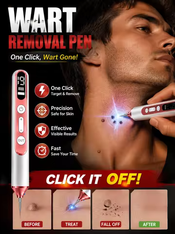 Plasma Pen for warts Remover Mole Removal Pen Skin Tag Freckle Spot Care Electric Arc Beauty Tool