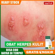 Obat Herpes Kulit - Obat Luka Kering - Luka Lepuhan - Herpes Basah Pria Wanita - Herves di Bibir - p