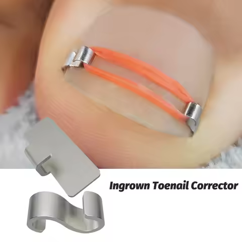 1/2pc Ingrown Toenail Corrector Pedicure Recover Embed Toe Nail Treatment Professional Ingrown Toena