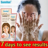 [100% Asli ] Salep vitiligo, panu, biang keringat, salep panu anti bakteri dengan cepat, musuh panu,