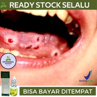 Obat Sariawan Di Lidah Obat Untuk Sariawan Obat Sariawan Di Lidah Obat Sariawan Di Bibir Obat Radang