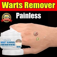 Warts Remover Cream 50g Warts Remover Original Mole Remover Effective Skin Tags And Warts Remover Fa