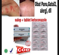 Paket Ketoconazole Salep &amp; Tablet) Gatal Paling Ampuh / Salep Gatal Kulit Jamur Ampuh / Obat Salep Gatal Kulit / Salep Gatal Jamur Selangkangan / Salep Kulit Gatal Selangkangan / salep manjur / saleb manjur Obat Gatal Jamur / Obat Gatal Alergi