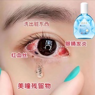 Anti-inflammatory eye drops, eye droppings, red bl Anti-inflammatory eye drops eye drops red Blood Sterilization Anti-itching Relieve Fatigue Dry Foreign Body Pearl eye drops eye drops 2024 Ready stock 0228 Follow Store to Get Discounts
