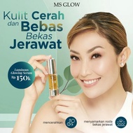 Serum MS Glow Whitening Gold / Serum Acne / Face Serum Luminous Glowing Peeling Lifting / All Varian