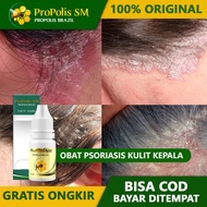 Obat Psoriasis Kulit Kepala Kulit Kepala Bersisik Ketombe Berkerak Jamur Di Kepala Borok Kulit Kepal