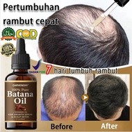 Batana oil hair growth serum rosemary oil for hair tonic growth hair serum for hair growth for Stron
