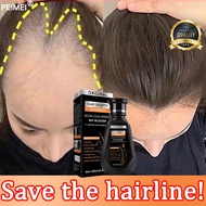 Hair loss shampoo Ginger shampoo, Ginger hair growth shampoo PEIMEI 250ML helps prevent hair loss, r