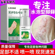 Blister Type Foot Moss Small Blister Blister Blister Blister Blister Blister Blister Blister Blister