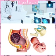 NAV Human Pregnant Pelvis Section Model with Removable Organs Human Female Pelvis with  9 Months Bab