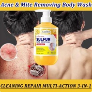 Sulfur shower gel,acne removal,whitening,antibacterial,sabun mandi itching shower gel Acne and mite 