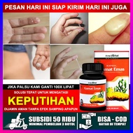 Obat Keputihan Becek / Keputihan Gatal / Keputihan Bau Dan Gatal / Keputihan Untuk Ibu Hamil / Keput