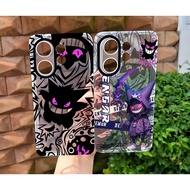 Softcase VIVO V60 Clear Case Motif Casing VIVO V60 Latest Silicone Airbag