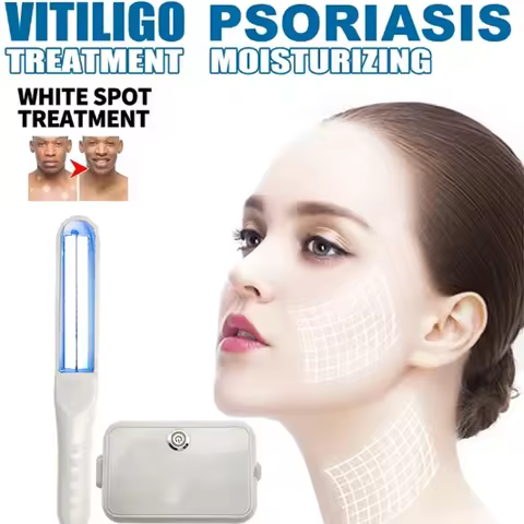 Excimer Phototherapy Lamp 311nm UVB for Vitiligo Psoriasis Eczema Pityriasis Treatment Rose Spots Sk