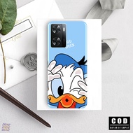Oppo A57 2020/A77S - Case hp - Casing hp - Softcase Case Oppo A57 2020/A77S - Casing hp - Softcase -