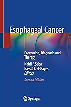 Esophageal Cancer: Prevention, Diagnosis and Therapy