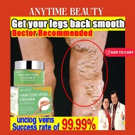 Sefudun Varicose Veins Cream: Your Ultimate Varicose Vein Remover Spider Vein Pain Killer Cream