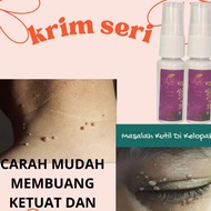 Skin Tag, Mole, Corn & Wart- Buang Tahi Lalat, Kutil, Ketuat, Ketuat Kaki
