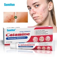 ครีมรักษาสิว Sumifun Rosacea 20กรัมรักษาสิวจมูกแดงแผลเป็นสิวซ่อมแซมครีมควบคุมความมันความชุ่มชื้นดูแล