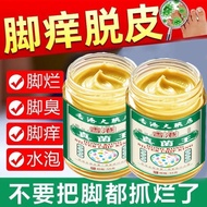 Fungal King Fungal King Fungal King Hong Kong Fungal Athlete's Foot Odor Foot Odor Toes Odor Peeling