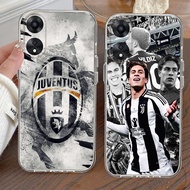 S9 J_Juventus TPU Case for OPPO A38 Reno 13F A17 A78 A60 A58 A18 5G