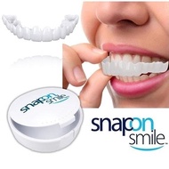 Karisma Market Import Snap On Smile Orinal 100% Snap On Smile Sepasang