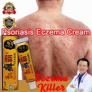 Psoriasis Cream Eczema Cream Antibacterial Ointment for Eczema Psoriasis Treatment Anti Fungal