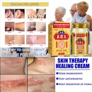 Medicine for itchy skin, itchy skin cream, Chinese herbal eczema cream, itchy eczema cream, itchy sk