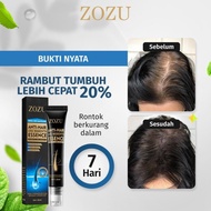 SPEKTAKULER Serum penumbuh rambut penumbuh rambut Penumbuh rambut