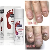 [包順豐運費] 加拿大 Footlogix 7T 灰甲寶 50ml [行貨］