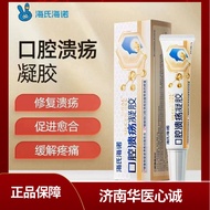 Heineno Oral Ulcer Dedicated Gel Patch Oral Ulcer Tongue Fire Ointment Repair Oral Ulcer Gel