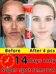 ✆✸  Freckle Whitening Cream Black Dots Melasma Remover Anti Brown Stain Lighten Pigmentation Moisturizing Korean Skin Care Products