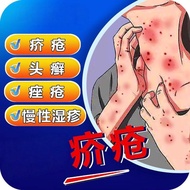 Infectious Scabies Skin Itching Red Spots Hills Pimples Blisters Blisters Night Weightening Itching 