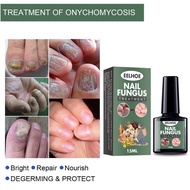 EELHOE NAIL FUNGUS TREATMENT RAWATAN KULAT KUKU CAGU KUKU ROSAK penghapus kulat kuku nail care rawat