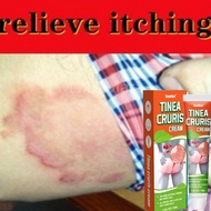 Krim Gatal Kulit Eczema Cream Ubat Gatal Celah Kangkang Psoriasis Cream Ubat Gatal Kemaluan Private 