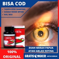 Obat Retina Jatuh - Ablasi Retina (Tanpa Efek Samping) Ablasio Retina - Retina Mata Yang Robek - Ret