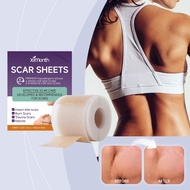 Ximonth Silicone Scar Sheet 4cmx150cm Remover Scar Patch Treatment Acne Trauma Burn Reduce Scar