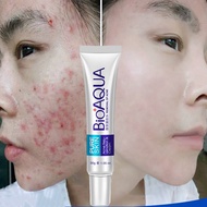 BIOAQUA Brand Skin Care Face Acne Treatment Acne Scars Cream Anti Acne Removal Gel Whitening Moisturizing Cream 30g
