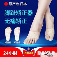 （24H）【滿300發貨】分趾器 矯正器 日本品牌拇指外翻矯正器大腳骨外翻腳趾矯正器兒童成人男女可穿鞋  露天市集  全