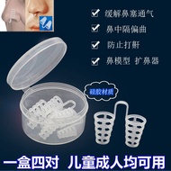 鼻孔支撑器/鼻孔矫正器 gmentation rhinoplasty, snoring and snoring prevention device, nasal clamp, nasal congestion dilator