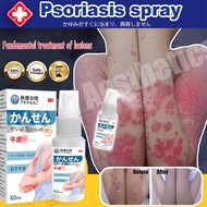 Japan Psoriasis Spray Scalp Psoriasis Treatment Eczema Antifungal Spray Itch Relief Eczema Therapy